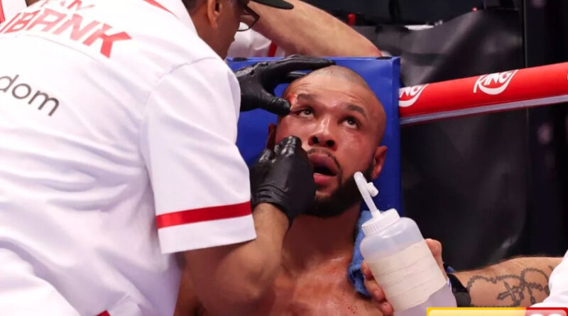 conor benn ungkap cedera mengerikan chris eubank jr usai duel sengit dia patah rahang