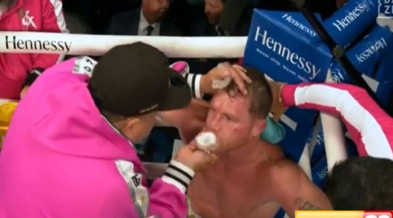 david benavidez kirim canelo ke rumah sakit jose sr dia sangat kuat