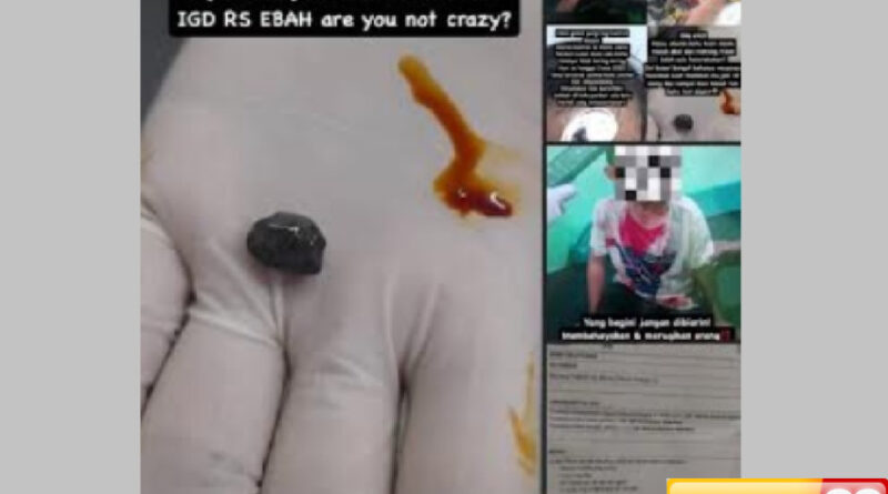 viral batu kerikil terjahit di jidat anak malapraktik diduga terjadi di rsud majalaya