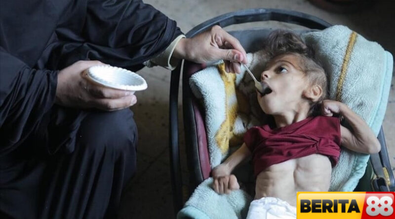hamas sebut israel jalankan kebijakan kelaparan massal di gaza 17000 anak malnutrisi parah